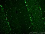 SORLA Antibody in Immunohistochemistry (Paraffin) (IHC (P))