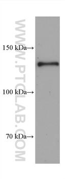 Collagen Type VI Antibody in Western Blot (WB)