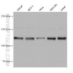 SMC5 Antibody in Western Blot (WB)