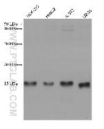 RNF7 Antibody in Western Blot (WB)