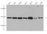SDCCAG1 Antibody in Western Blot (WB)