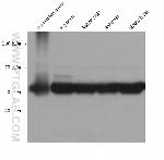 NPTX2 Antibody in Western Blot (WB)