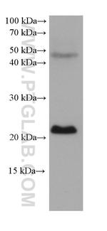 EMC7/C15orf24 Antibody in Western Blot (WB)