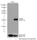 TREM2 Antibody in Western Blot (WB)
