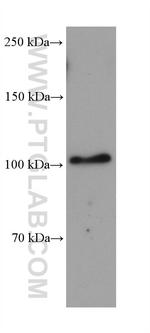 ADAM17 Antibody in Western Blot (WB)