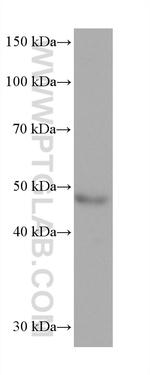 AP1M1 Antibody in Western Blot (WB)