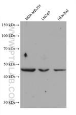 AP1M1 Antibody in Western Blot (WB)