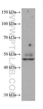 AP1M1 Antibody in Western Blot (WB)