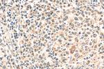 Cleaved Caspase 3 p17 Antibody in Immunohistochemistry (Paraffin) (IHC (P))
