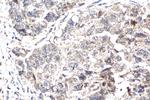 Cleaved Caspase 3 p17 Antibody in Immunohistochemistry (Paraffin) (IHC (P))