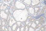 CALCA/CGRP Antibody in Immunohistochemistry (Paraffin) (IHC (P))