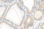 CALCA/CGRP Antibody in Immunohistochemistry (Paraffin) (IHC (P))