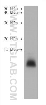 CALCA/CGRP Antibody in Western Blot (WB)