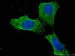 CHMP4B Antibody in Immunocytochemistry (ICC/IF)