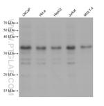 CHMP4B Antibody in Western Blot (WB)