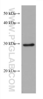EIF2B1 Antibody in Western Blot (WB)