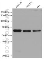 CORO1C Antibody in Western Blot (WB)
