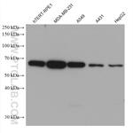 CORO1C Antibody in Western Blot (WB)