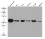 ZC3H12D Antibody in Western Blot (WB)