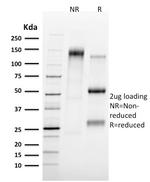 Tal1 Monoclonal Antibody (TAL1/2707)