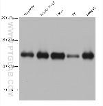SPHK2 Antibody in Western Blot (WB)