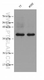 MLXIP Antibody in Western Blot (WB)