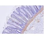 Smooth Muscle Actin Antibody in Immunohistochemistry (Paraffin) (IHC (P))