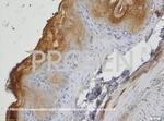 Ep-CAM Antibody in Immunohistochemistry (IHC)