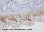 Ep-CAM Antibody in Immunohistochemistry (IHC)