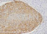 Ep-CAM Antibody in Immunohistochemistry (IHC)