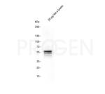 Keratin Type II Antibody in Western Blot (WB)