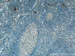 IL-6 Antibody in Immunohistochemistry (Paraffin) (IHC (P))