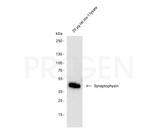 Synaptophysin Antibody in Western Blot (WB)