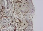 Vimentin Antibody in Immunohistochemistry (IHC)