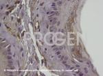 Vimentin Antibody in Immunohistochemistry (IHC)