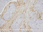Vimentin Antibody in Immunohistochemistry (IHC)