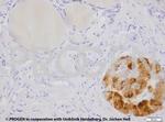 Cytokeratin 7 Antibody in Immunohistochemistry (IHC)
