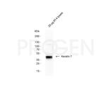Cytokeratin 7 Antibody in Western Blot (WB)