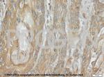 Cytokeratin 5/8 Antibody in Immunohistochemistry (IHC)
