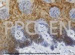 Cytokeratin 5/8 Antibody in Immunohistochemistry (IHC)