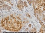 Cytokeratin 17 Antibody in Immunohistochemistry (IHC)