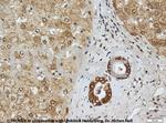 Cytokeratin 8 Antibody in Immunohistochemistry (IHC)