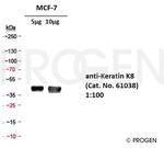 Cytokeratin 8 Antibody in Western Blot (WB)