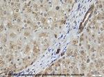 Cytokeratin 8 Antibody in Immunohistochemistry (IHC)
