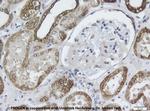 Cytokeratin 8 Antibody in Immunohistochemistry (IHC)