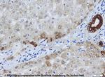 Cytokeratin 8 Antibody in Immunohistochemistry (IHC)