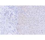 Cyclin D1 Antibody in Immunohistochemistry (Paraffin) (IHC (P))
