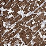 Cardiac Actin Antibody in Immunohistochemistry (IHC)