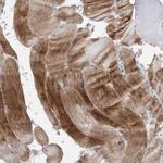 Synaptopodin/SYNPO Antibody in Immunohistochemistry (IHC)