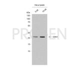 Cyclin-Dependent Kinase 4 Antibody in Western Blot (WB)